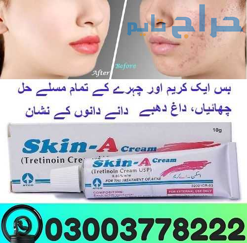 Skin A Cream 0.05% Price In Pakistan | 03003778222