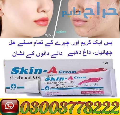 Skin A Cream 0.05% Price In Pakistan | 03003778222